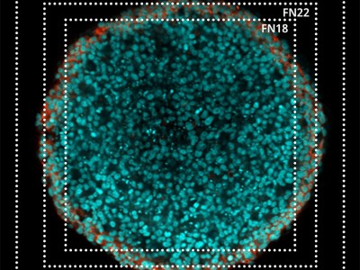 全电动倒置显微镜IXplore IX85 SpinXL图3