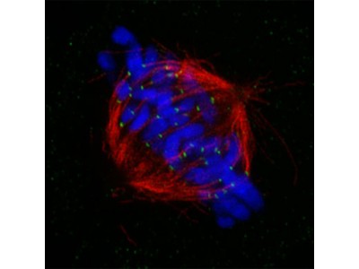 全电动倒置显微镜IXplore SpinSR超分辨率系统图2