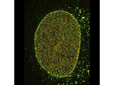 全电动倒置显微镜IXplore SpinSR超分辨率系统图3